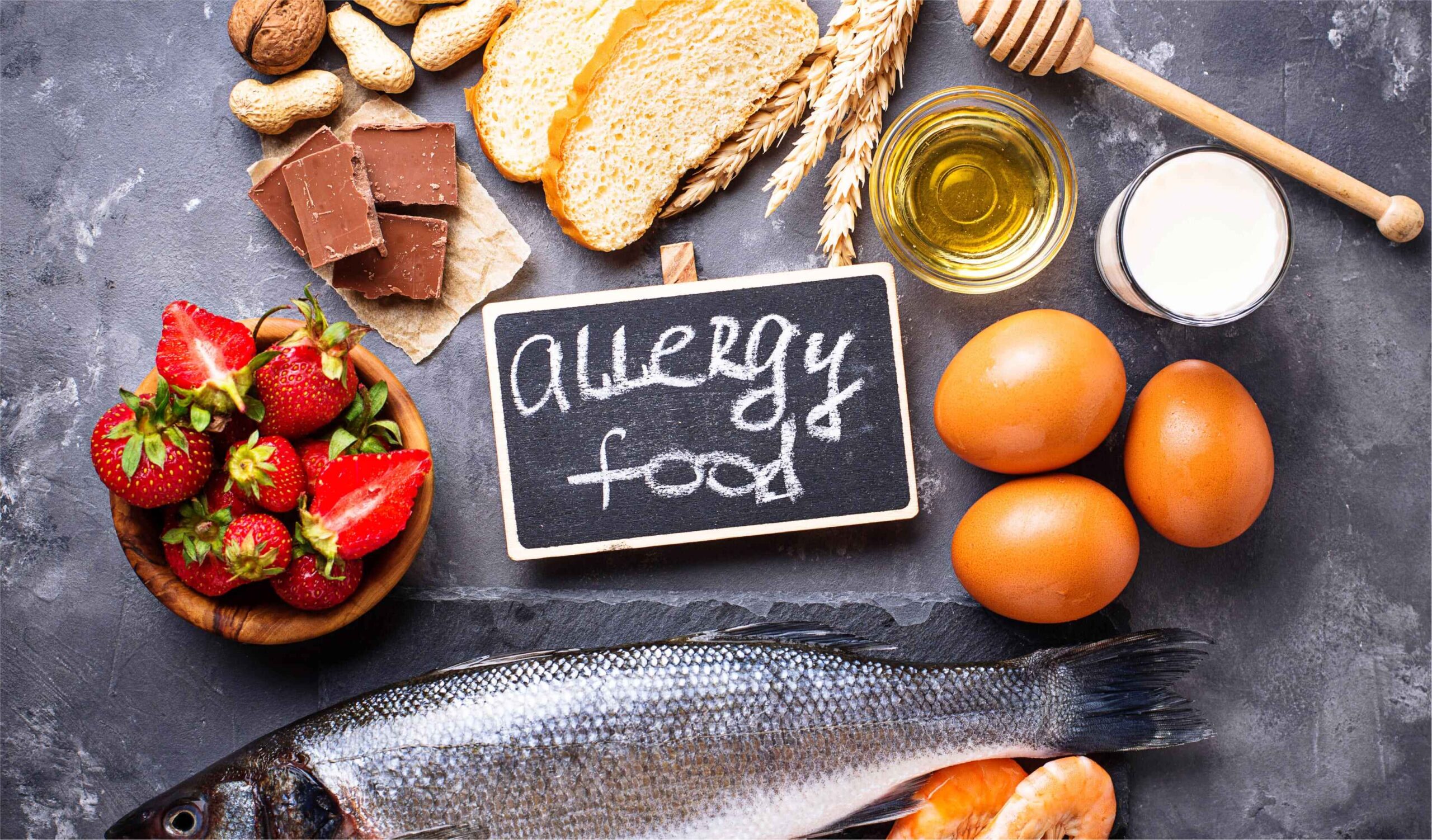 GESTIÓN DE ALÉRGENOS EN EL SECTOR DE LA RESTAURACIÓN – SANP0008